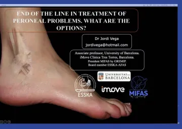 End of the line in treatment of peroneal problems, what are the options?