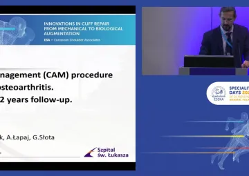 Comprehensive Arthroscopic Management (CAM) as prevention of OA in young patients