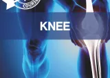 Endorsed Knee